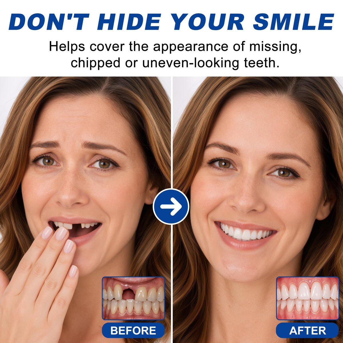 Moldable False Teeth U148